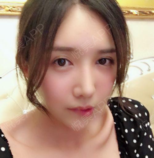 吃冰瓜后鼻子不通,揭秘夏日清凉背后的健康隐患